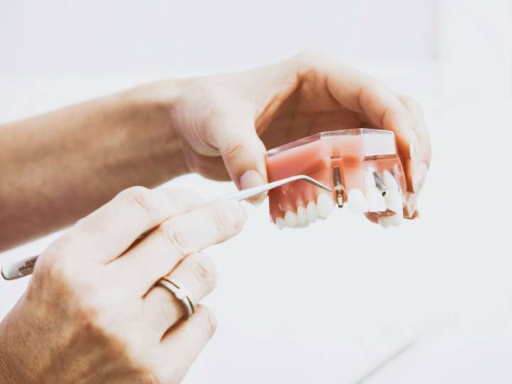 impianti-zirconio-vantaggi-svantaggi-e-applicazioni immagine dell'articolo