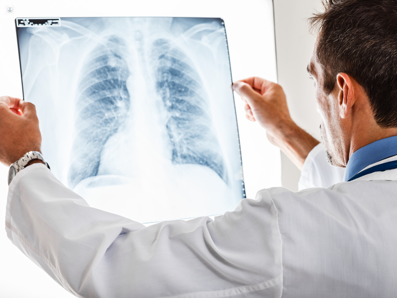 radiografia dei polmoni
