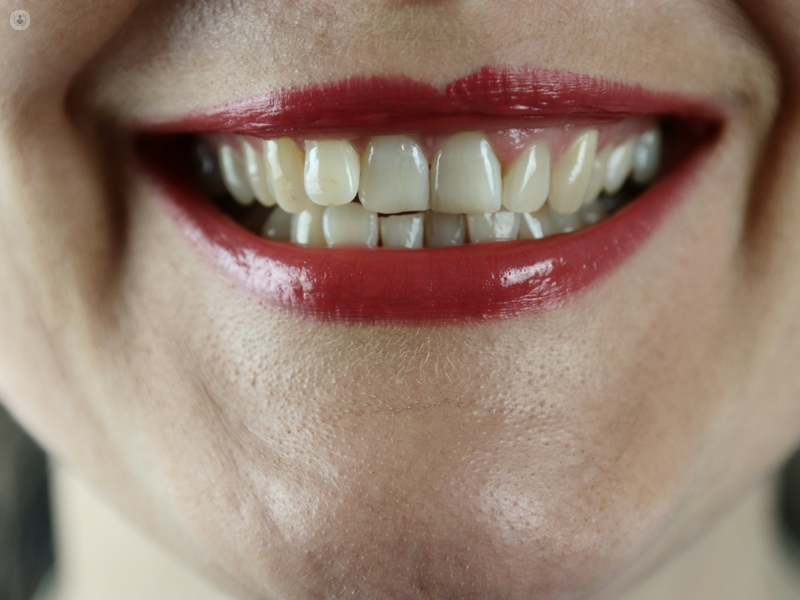 sorriso di una ragazza