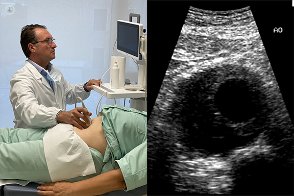 Dott. Tinelli che esegue un ecocolordoppler