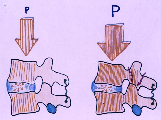 immagine colonna vertebrale