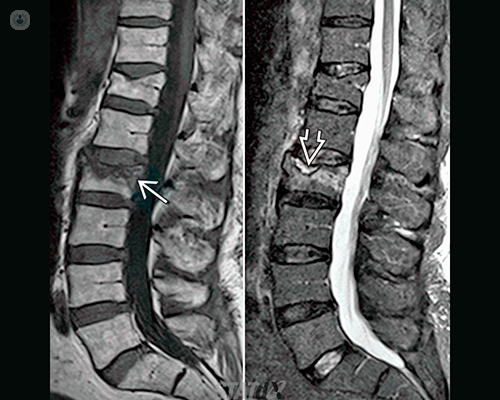 radiografia colonna vertebrale