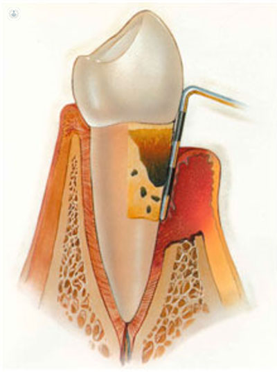 immagine di un dente