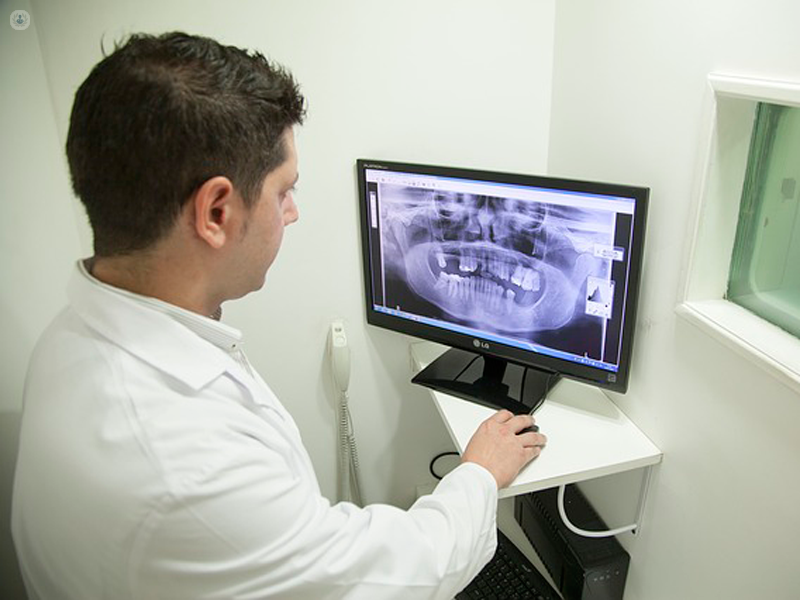 dentista al computer visionando una radiografia