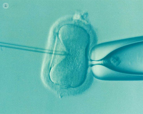 immagine dell’iniezione intracitoplasmatica dello spermatozoo 