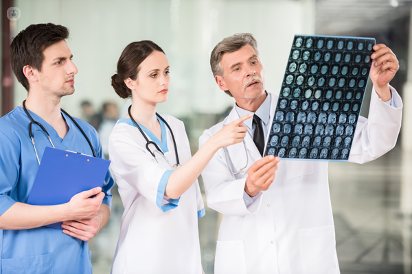 Dottori che guardano una radiografia del cervello