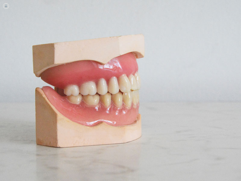 modellino di denti