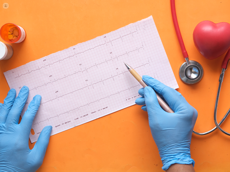 visita di controllo con risultati di un elettrocardiogramma