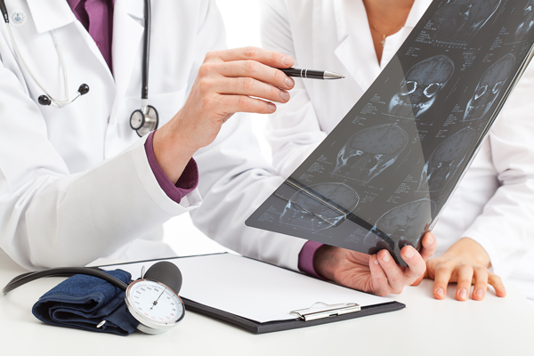 medico che osserva radiografia del cervello