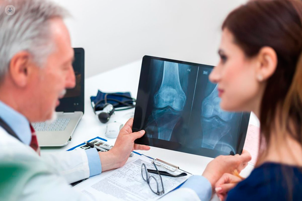 medico che mostra ad una paziente una radiografia al ginocchio