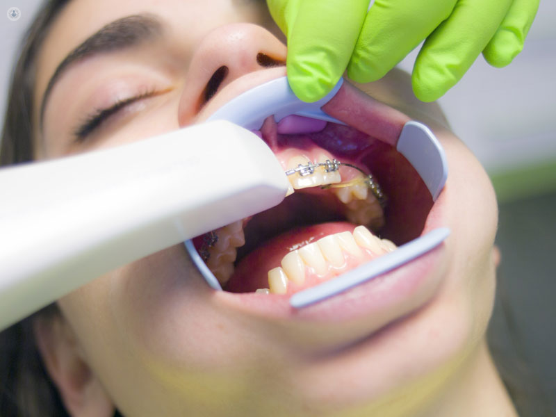 bimba dal dentista con apparecchio ortodontico