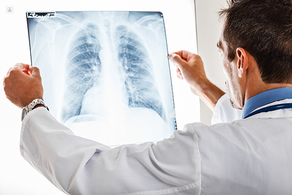 dottore che quarda una radiografia dei polmoni