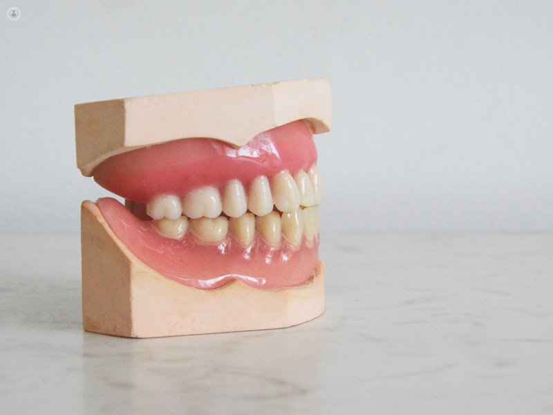 modellino dei denti
